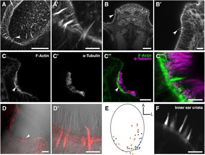 Olfactory Rod Cells: A Rare Cell Type in the Larval Zebrafish Olfactory Epithelium With a Large Actin-Rich Apical Projection